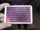 Why Magnetic Protein A Beads Reduce Manual Processing Errors?